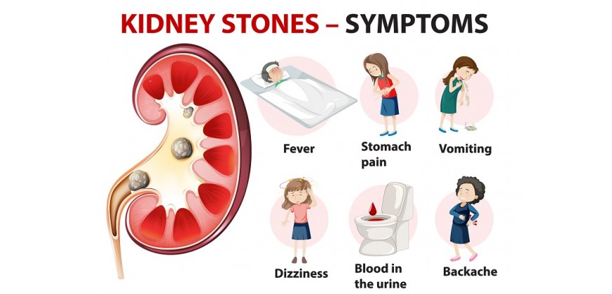 Homoeopathic Remedies for Kidney Stone